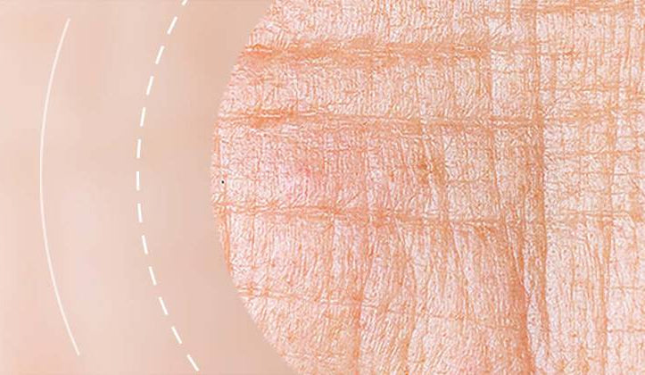 Fine Lines + Wrinkles