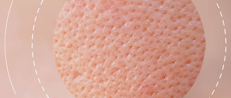 Uneven Skin Texture – Healy Plastic Surgery