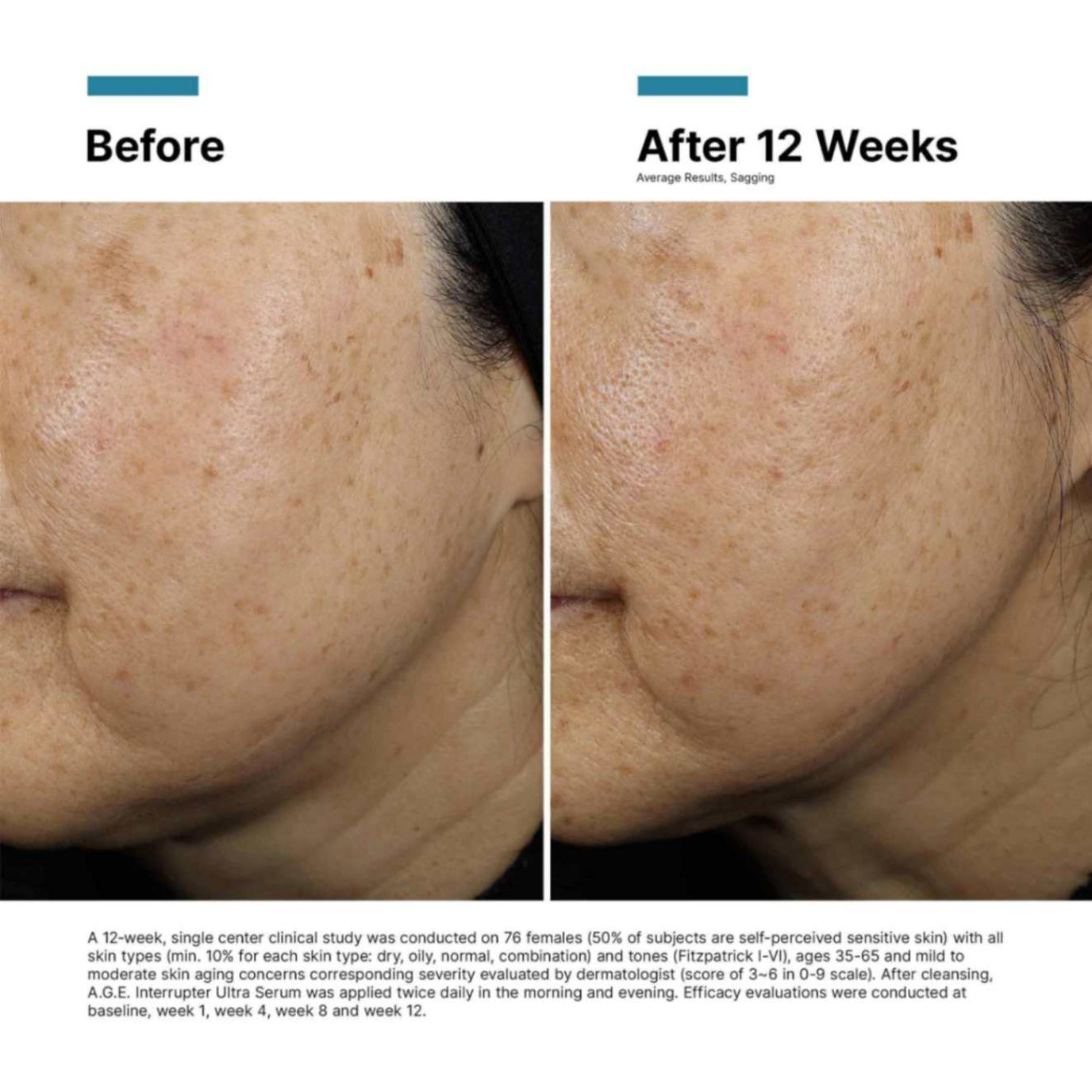 *NEW* A.G.E Interrupter Ultra Serum