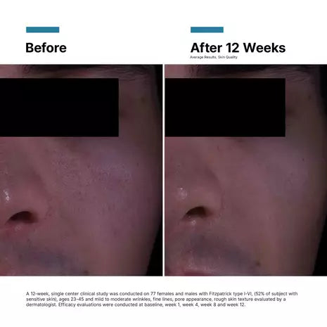 P-TIOX Anti-Wrinkle Cream
