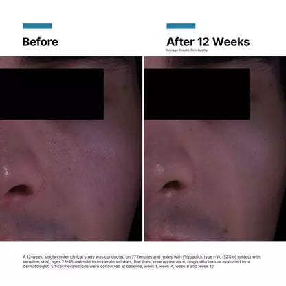 P-TIOX Anti-Wrinkle Cream