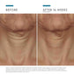 Tripeptide-R Neck Repair