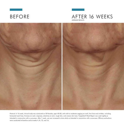 Tripeptide-R Neck Repair